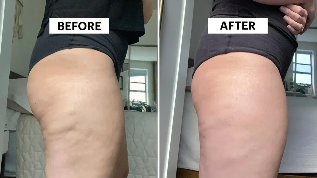 Do Toning Exercise Bicester Really Tackle Cellulite?