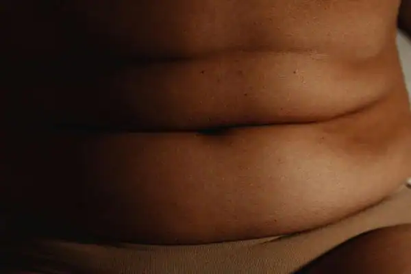 The Hidden Connection: How Stress Shapes Your Fitness and Body Composition 3 image of what stress can do on the stomach area and how Lipo 360 Bicester can help to change your body shape.