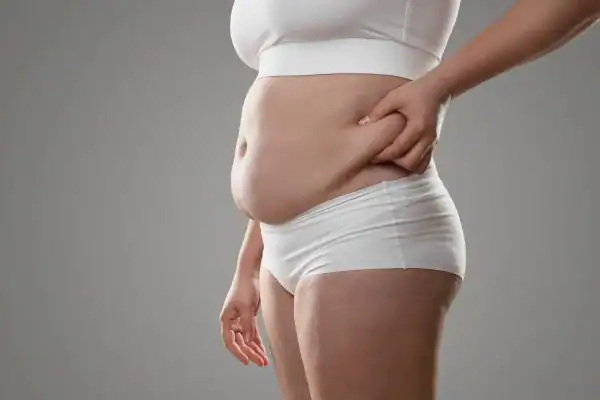 Image of stress belly Bicester How Lipo 360 can help manage your symptoms